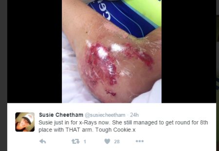 susie cheetham injury1